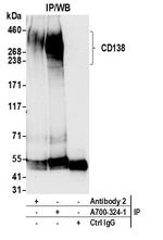 CD138 Antibody in Immunoprecipitation (IP)