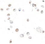 p14ARF Antibody in Immunocytochemistry (ICC/IF)