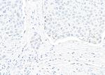 p14ARF Antibody in Immunohistochemistry (Paraffin) (IHC (P))