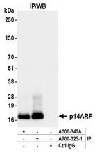 p14ARF Antibody in Immunoprecipitation (IP)