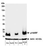 p14ARF Antibody in Western Blot (WB)