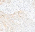 N-Ras Antibody in Immunohistochemistry (Paraffin) (IHC (P))