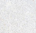 MEF2C Antibody in Immunohistochemistry (Paraffin) (IHC (P))