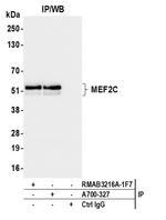 MEF2C Antibody in Immunoprecipitation (IP)