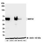 MEF2C Antibody in Western Blot (WB)