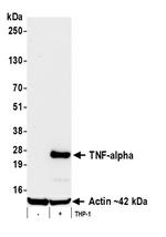 TNF-alpha Antibody in Western Blot (WB)
