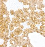 Cytokeratin 5 Antibody in Immunohistochemistry (Paraffin) (IHC (P))