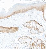 Cytokeratin 5 Antibody in Immunohistochemistry (Paraffin) (IHC (P))
