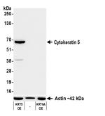 Cytokeratin 5 Antibody in Western Blot (WB)
