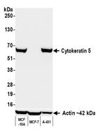Cytokeratin 5 Antibody in Western Blot (WB)