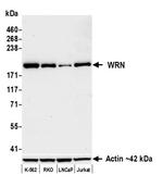 WRN Recombinant Rabbit Monoclonal Antibody (BLR333M)