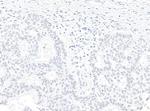 ZC3H4 Antibody in Immunohistochemistry (Paraffin) (IHC (P))