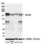 ZC3H4 Antibody in Western Blot (WB)