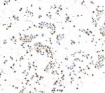 ZC3H4 Antibody in Immunocytochemistry (ICC/IF)