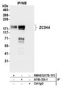 ZC3H4 Antibody in Immunoprecipitation (IP)