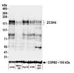 ZC3H4 Antibody in Western Blot (WB)