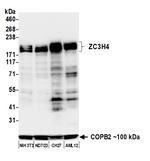 ZC3H4 Antibody in Western Blot (WB)