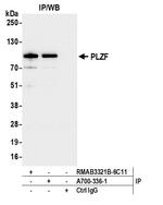 PLZF Antibody in Immunoprecipitation (IP)