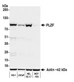 PLZF Recombinant Rabbit Monoclonal Antibody (BLR336M)