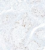 p21/CIP1/CDKN1A Antibody in Immunohistochemistry (Paraffin) (IHC (P))