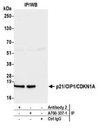 p21/CIP1/CDKN1A Antibody in Immunoprecipitation (IP)