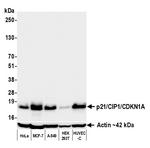 p21/CIP1/CDKN1A Antibody in Western Blot (WB)