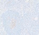 EZH2 Antibody in Immunohistochemistry (Paraffin) (IHC (P))
