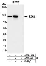 EZH2 Antibody in Immunoprecipitation (IP)