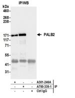 PALB2 Antibody in Immunoprecipitation (IP)