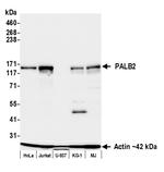 PALB2 Recombinant Rabbit Monoclonal Antibody (BLR339M)
