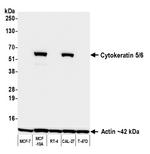 Cytokeratin 5/6 Recombinant Rabbit Monoclonal Antibody (BLR340M)