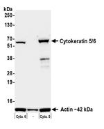 Cytokeratin 5/6 Antibody in Western Blot (WB)