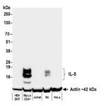 IL-5 Recombinant Rabbit Monoclonal Antibody (BLR343M)