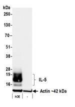 IL-5 Antibody in Western Blot (WB)