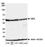 IRF3 Recombinant Rabbit Monoclonal Antibody (BLR344M)