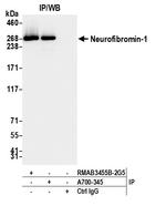 Neurofibromin 1 Antibody in Immunoprecipitation (IP)