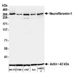 Neurofibromin 1 Antibody in Western Blot (WB)