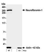 Neurofibromin 1 Antibody in Western Blot (WB)