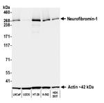 Neurofibromin 1 Recombinant Rabbit Monoclonal Antibody (BLR345M)