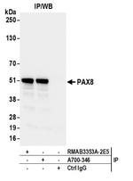 PAX8 Antibody in Immunoprecipitation (IP)