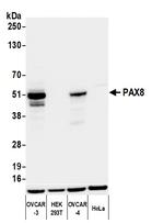 PAX8 Antibody in Western Blot (WB)