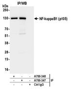 NF-kappaB1 (p105) Antibody in Immunoprecipitation (IP)