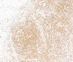 NF-kappaB1 (p105/p50) Antibody in Immunohistochemistry (Paraffin) (IHC (P))