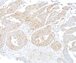 NF-kappaB2 (p100) Antibody in Immunohistochemistry (Paraffin) (IHC (P))