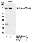 NF-kappaB2 (p100) Antibody in Immunoprecipitation (IP)