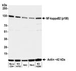 NF-kappaB2 (p100) Antibody in Western Blot (WB)