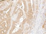NF-kappaB2 (p100/p52) Antibody in Immunohistochemistry (Paraffin) (IHC (P))