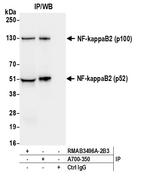 NF-kappaB2 (p100/p52) Antibody in Immunoprecipitation (IP)