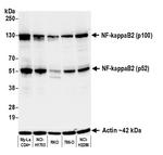NF-kappaB2 (p100/p52) Antibody in Western Blot (WB)