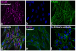 Donkey anti-Rat IgG (H+L) Highly Cross-Adsorbed Secondary Antibody, Alexa Fluor™ 647